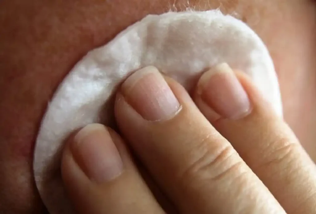 Primer plano de tratamiento facial