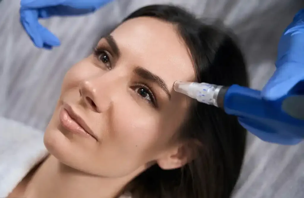 Paciente en pleno tratamiento de microneedling facial.